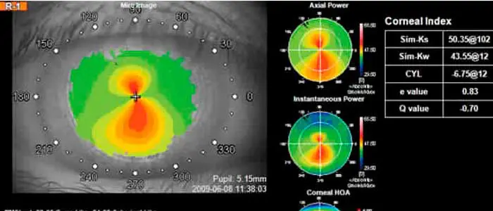 Our Edmonton Eye Exams - Keratometry: Measuring The Curvature of the Cornea