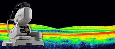 Exam Advanced Eye Testing: Optical Coherence Tomography