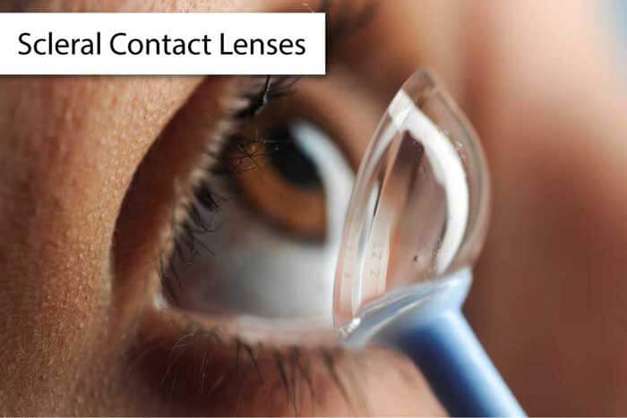 Contact Lens Eye Exams: More Than Just A Regular Eye Exam
