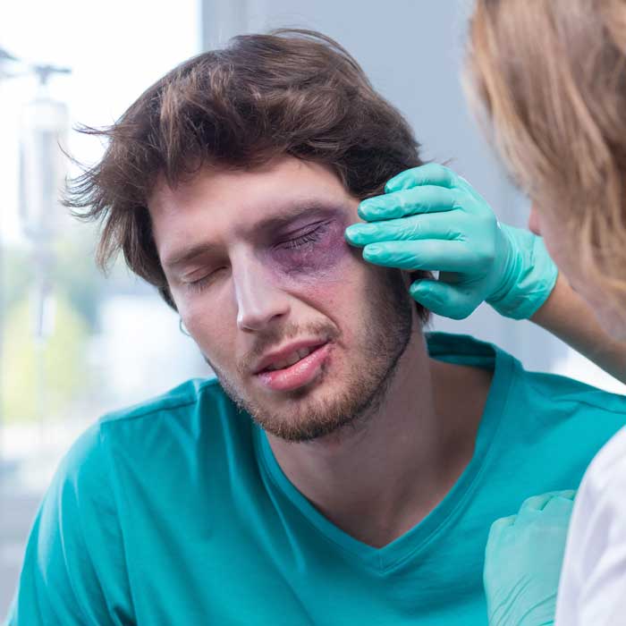 Eye Emergency: Blunt Force Trauma
